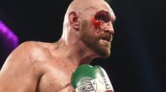 Fury krvácel, přesto zápas vyhrál. Pak musel do nemocnice na šití