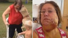 Nejdrsnější kyblíková výzva: Ženu kousnul do tváře pitbull! VIDEO