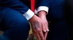 Záběry Trumpa vyvolaly divoké spekulace o jeho zdraví. Bílý dům má bizarní vysvětlení