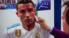 Ronaldovo krvavé zranění zblízka: Tohle dělal lékař v kabině! VIDEO