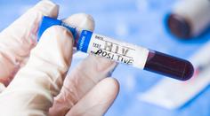 Experti odhalili nakažlivější variantu HIV. Šířila se už v 80. letech