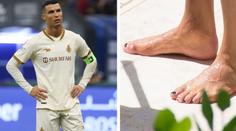 Proč si Ronaldo lakuje nehty na černo? Důvod je praktický