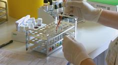 V Česku roste počet nakažených žloutenkou. Hygienici zavádějí opatření