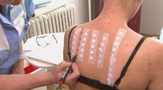 Alergiků stále přibývá. Experti prozradili příčiny i možnosti léčby
