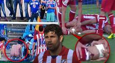VIDEO: Holý zadek, zahozená penalta a tržná rána na holeni! Costa byl u všeho