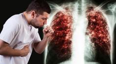 Firmu v Jihlavě děsí "tubera", na testy musejí desítky zaměstnanců!