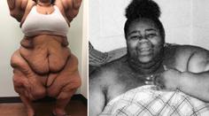 Musíte vidět: Nejtěžší žena světa shodila 200 kilogramů! GALERIE