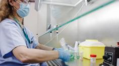Vědci vyvinuli test na opičí neštovice. V Česku hygienici evidují 39 nakažených