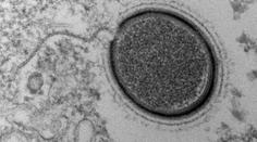 Vědci chtějí oživit obří virus ze Sibiře. Je starý 30 tisíc let!