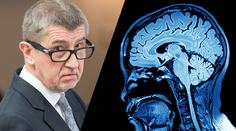 Nemoci Babišových dětí přináší myšlenky na smrt, říká psychiatr