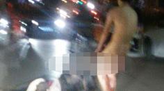 Zhrzená žena: Nevěrnému muži (32) dvakrát uřízla penis! FOTKY