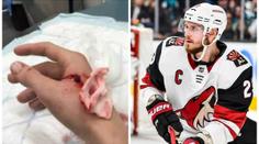 Stehy a tetanus! Hvězdného obránce NHL pokousal jeho vlastní pes