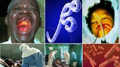 Vše o viru EBOLA: Kde se vzala a jaké má PŘÍZNAKY?