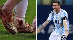 Válečník Messi: Nezastavilo ho šest faulů za žlutou kartu ani krvavý kotník