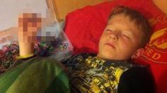 Gumičková závislost: Školák (8) málem přišel o prsty! Foto uvnitř