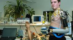 Ruce má jako robot. Protézy řídí myšlenkami