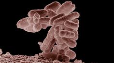 HYGIENIK RADÍ: Jak se bránit nebezpečné bakterii E.coli