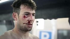 Smolař Cavendish opět spadnul a závod končil v krvi! VIDEO