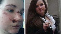 Záhada! Terezu (28) našli v kaluži krve. Nepamatuje si, co se stalo
