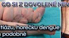 Co si z dovolené nevozit: elefantiázu, horečku dengue ani jim podobné