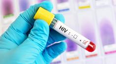 V Česku rostou případy HIV. Lidé si myslí, že se jich infekce netýká