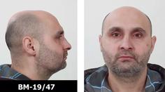 Policie pátrá po ozbrojeném muži! Pobodal servírku a utekl i s penězi