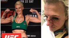 UFC zápasnice se stala obětí domácího násilí. Zmlátil ji expřítel