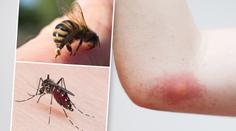 Alergici mají pohotovost. Nebezpečný hmyz je velmi aktivní
