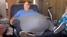 Děsivé! Muži (63) roste z břicha nádor, který váží STO KILO!