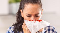 Někteří lidé v létě krvácí z nosu. Experti řekli důvod, varují před zakláněním hlavy
