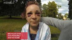 Grázlové si užili s prostitutkou v Chebu, místo placení ji drsně zbili