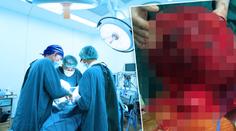 Ženě vyoperovali obří nádor. Mohlo ji zabít ťuknutí do břicha