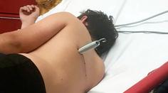 Hra na trampolíně se změnila v horor! Chlapec skončil s pružinou v zádech