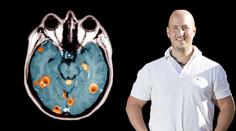 "Někdo má občas chřipku, já rakovinu," říká. Přežil ji osmkrát