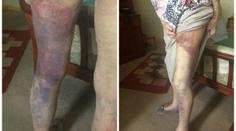 Lupič přepadl babičku (92) kvůli stovce! Utrpěla děsivá zranění