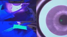Operace očí za 10 sekund. Nejrychlejší laser na světě nabídne nový komfort