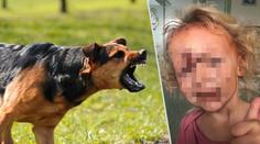Rozárku (3,5) pokousal pes v obličeji. Z nejhoršího je dívenka venku