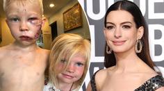 Hrdina (6) uchránil svou sestričku před psem. Celebrity mu vzdaly hold