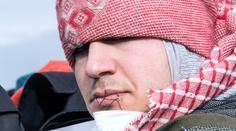 Bourání tábora v Calais: Uprchlíci protestují SEŠITÝMI ÚSTY