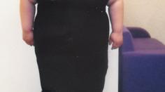 Anička byla ohavná koule: Jak vypadá o 100 kg lehčí? FOTO