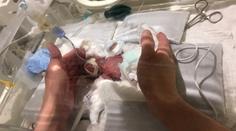 Chlapeček po narození vážil 268 gramů. Teď ho pustili z nemocnice