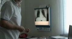 Ve vsi chodil muž nakažený tuberkulózou