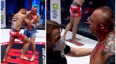 VIDEO jen pro otrlé! Nechybělo málo a MMA zápasník přišel o ucho
