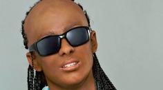 Úžasná proměna: Z Adama Mišíka se stal Stevie Wonder!