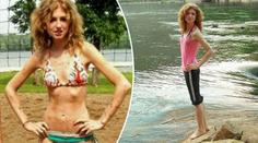 Trpěla anorexií. Pak k ní promluvil bůh a změnila se k nepoznání