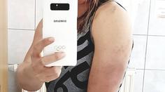 Ledecká zveřejnila šokující foto po Velikonocích! Takhle dopadla