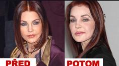 Zpackaná plastika. Priscilla Presley vypadá hrozně