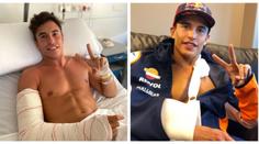Marquez musí na další operaci! Řeší se, zda stihne start v Brně