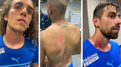 Hráči Marseille po konfliktu s fanoušky: Rány na krku i zádech