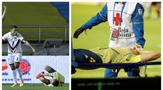 Jen pro otrlé: Schickův spoluhráč utrpěl s reprezentací děsivé zranění
